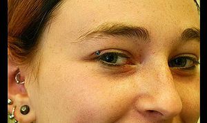 Eye microdermal.jpg